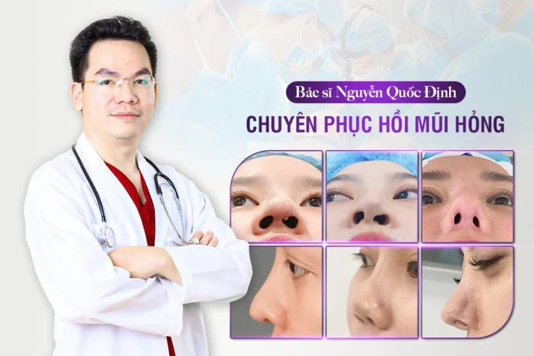 Lấy lại vẻ đẹp hoàn mỹ sau 2 lần nâng mũi thất bại