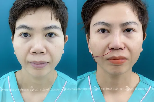 Độn Thái Dương