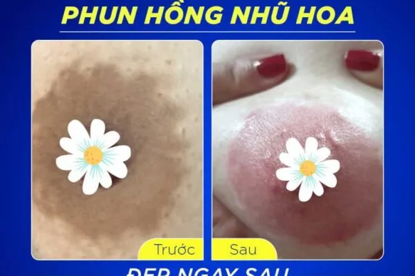 Làm Hồng Nhũ Hoa