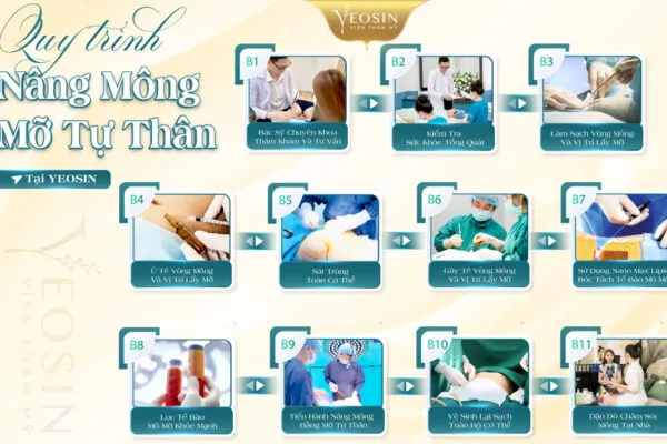 Nâng Mông Bằng Mỡ Tự Thân