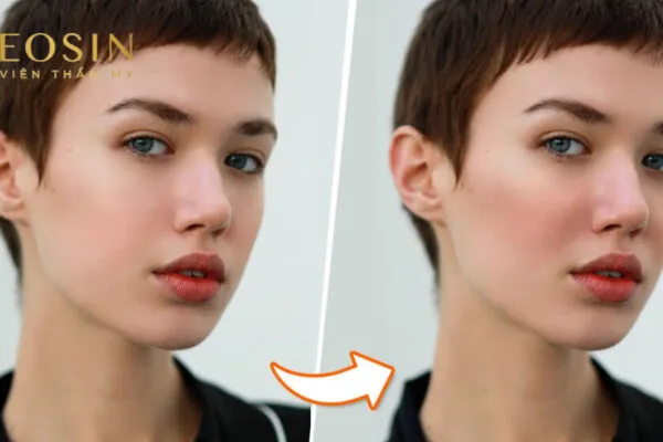 Tạo Hình Má Baby