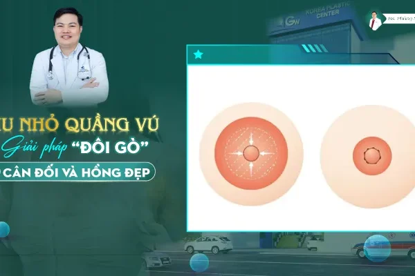 Thu Nhỏ Quầng Vú